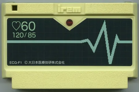 家庭心电图机